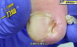 修理小姐姐的脚趾甲,修理小姐姐的精致脚趾甲之旅